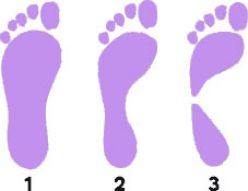 foot types